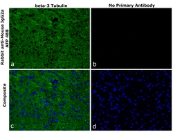 Invitrogen&trade;&nbsp;Rabbit anti-Mouse IgG2a Recombinant Secondary Antibody, Alexa Fluor&trade; Plus 488