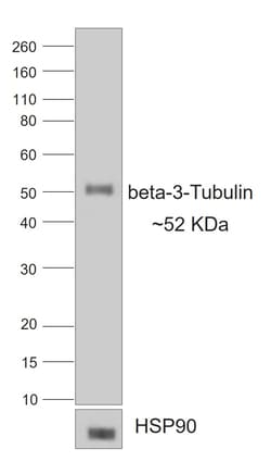 Invitrogen Rabbit anti-Mouse IgG2a Recombinant Secondary Antibody 250 &mu;L;