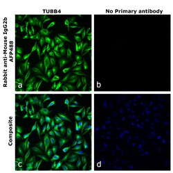 Invitrogen&trade;&nbsp;Rabbit anti-Mouse IgG2b Recombinant Secondary Antibody, Alexa Fluor&trade; Plus 488