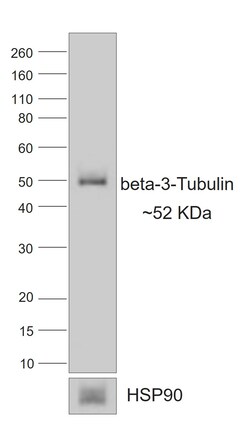 Invitrogen Rabbit anti-Mouse IgG1 Recombinant Secondary Antibody 250 &mu;L | Buy Online | Invitrogen&trade; | Fisher Scientific