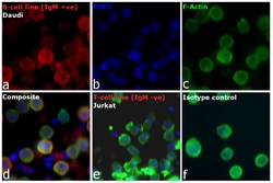 Invitrogen Goat anti-Human IgM Cross-Adsorbed Secondary Antibody, DyLight 650 500 &mu;g | Buy Online | Invitrogen&trade; | Fisher Scientific