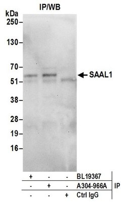 SAAL1 Rabbit anti-Human, Polyclonal, Bethyl Laboratories 100 &mu;L; Unconjugated:Antibodies,