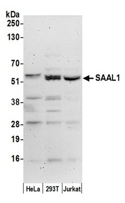 SAAL1 Rabbit anti-Human, Polyclonal, Bethyl Laboratories 100 &mu;L; Unconjugated:Antibodies,