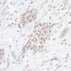 SAE1 Rabbit anti-Human, Polyclonal, Bethyl Laboratories 100 &mu;L; Unconjugated:Antibodies,