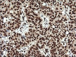 SAE1 Monoclonal Antibody (OTI1G8), TrueMAB , OriGene 100 &mu;L; Unconjugated:Antibodies,