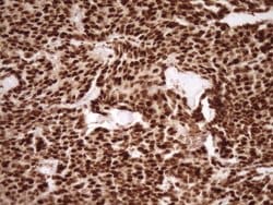 SAE1 Monoclonal Antibody (OTI6C7), TrueMAB , OriGene:Anticuerpos:Anticuerpos