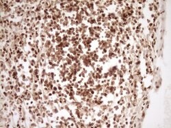 SAE1 Monoclonal Antibody (OTI6C7), TrueMAB , OriGene 30 &mu;L; Unconjugated:Anticuerpos