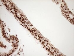 SAE1 Monoclonal Antibody (OTI6C7), TrueMAB , OriGene:Anticuerpos:Anticuerpos