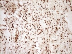 SAE1 Monoclonal Antibody (OTI6C7), TrueMAB , OriGene 30 &mu;L; Unconjugated:Anticuerpos
