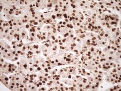 SAE1 Monoclonal Antibody (OTI6C7), TrueMAB , OriGene 30 &mu;L; Unconjugated:Anticuerpos
