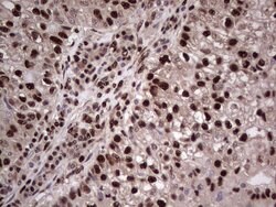 SAE1 Monoclonal Antibody (OTI6B11), TrueMAB , OriGene:Antibodies:Primary