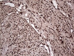 SAE1 Monoclonal Antibody (OTI6B11), TrueMAB , OriGene 30 &mu;L; Unconjugated:Antibodies,