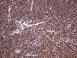 SAE1 Monoclonal Antibody (OTI6B11), TrueMAB , OriGene 30 &mu;L; Unconjugated:Antibodies,