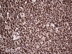 SAE1 Monoclonal Antibody (OTI6B11), TrueMAB , OriGene 30 &mu;L; Unconjugated:Antibodies,