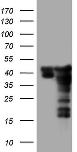 SAE1 Monoclonal Antibody (OTI6B11), TrueMAB , OriGene 30 &mu;L; Unconjugated:Antibodies,