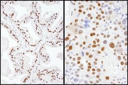 SAE2 Rabbit anti-Human, Mouse, Polyclonal, Bethyl Laboratories 100 &mu;L;