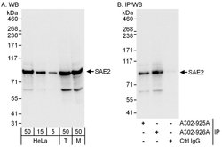 SAE2 Rabbit anti-Human, Mouse, Polyclonal, Bethyl Laboratories 100 &mu;L;