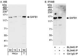 SAFB1 Rabbit anti-Human, Polyclonal, Bethyl Laboratories 100 &mu;L; Unconjugated:Antibodies,