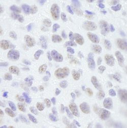 SAFB1 Polyclonal Antibody, Bethyl Laboratories 100 &mu;L | Buy Online | Bethyl Laboratories, Inc | Fisher Scientific
