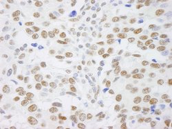 SAFB1 Polyclonal Antibody, Bethyl Laboratories 100 &mu;L | Buy Online | Bethyl Laboratories, Inc | Fisher Scientific