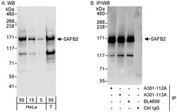 SAFB2 Rabbit anti-Human, Polyclonal, Bethyl Laboratories 100 &mu;L; Unconjugated:Antibodies,