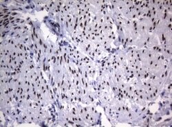SAMD12 Monoclonal Antibody (OTI2G1), TrueMAB , OriGene 100 &mu;L; Unconjugated:Antibodies,