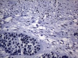 SAMD12 Monoclonal Antibody (OTI2G1), TrueMAB , OriGene 100 &mu;L; Unconjugated:Antibodies,