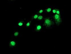 SAMHD1 Monoclonal Antibody (OTI2A5), TrueMAB , OriGene 100 &mu;L; Unconjugated:Antibodies,