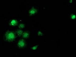 SAMHD1 Mouse anti-Human, Clone: OTI3G6, lyophilized, TrueMAB 100 &mu;g;