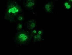 SAMHD1 Monoclonal Antibody (OTI2B5), TrueMAB , OriGene 100 &mu;L; Unconjugated:Antibodies,