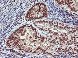SAMHD1 Monoclonal Antibody (OTI2A5), TrueMAB , OriGene 100 &mu;L; Unconjugated:Antibodies,