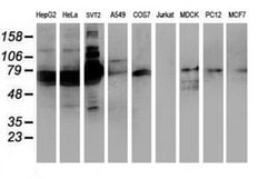 SAMHD1 Monoclonal Antibody (OTI2A5), TrueMAB , OriGene 100 &mu;L; Unconjugated:Antibodies,