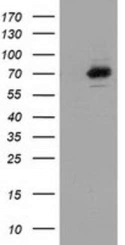 SAMHD1 Mouse anti-Human, Clone: OTI3G6, lyophilized, TrueMAB 100 &mu;g;