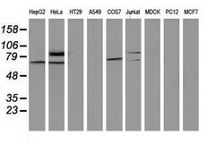 SAMHD1 Mouse anti-Human, Clone: OTI3G6, lyophilized, TrueMAB 100 &mu;g;