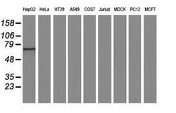 SAMHD1 Mouse anti-Human, Clone: OTI3B9, lyophilized, TrueMAB 100 &mu;g;