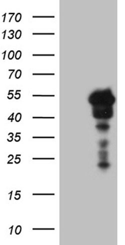 SAMSN1 Monoclonal Antibody (OTI1F6), TrueMAB , OriGene 100 &mu;L; Unconjugated:Antibodies,