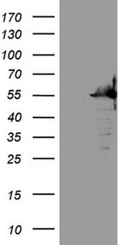 SAMSN1 Monoclonal Antibody (OTI7F5), TrueMAB , OriGene 100 &mu;L; Unconjugated:Antibodies,