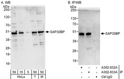 SAP30BP Rabbit anti-Human, Mouse, Polyclonal, Bethyl Laboratories 100 &mu;L;