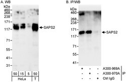SAPS2 Rabbit anti-Human, Polyclonal, Bethyl Laboratories 100 &mu;l; Unlabeled:Antibodies,