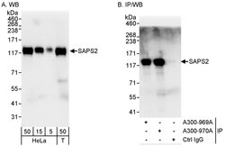 SAPS2 Rabbit anti-Human, Polyclonal, Bethyl Laboratories 100 &mu;L; Unconjugated:Antibodies,