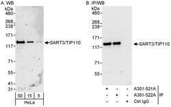 SART3/TIP110 Rabbit anti-Human, Polyclonal, Bethyl Laboratories 100 &mu;L;