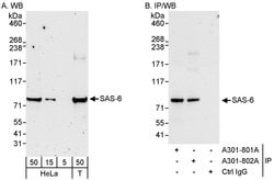 SAS-6 Rabbit anti-Human, Polyclonal, Bethyl Laboratories 100 &mu;L; Unconjugated:Antibodies,