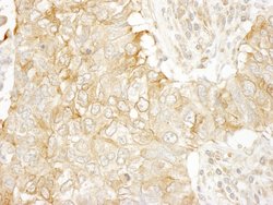 SASH1 Polyclonal Antibody, Bethyl Laboratories 10 &mu;L; Unconjugated:Antibodies,