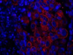 SASH1 Polyclonal Antibody, Bethyl Laboratories:Antibodies:Primary Antibodies