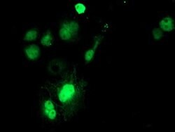 SAT2 Mouse anti-Human, Clone: OTI2A3, lyophilized, TrueMAB 100 &mu;g; Unconjugated:Antibodies,