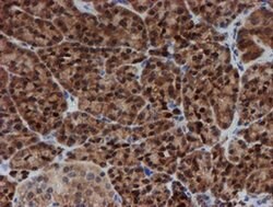 SAT2 Monoclonal Antibody (OTI1C9), TrueMAB , OriGene:Antibodies:Primary