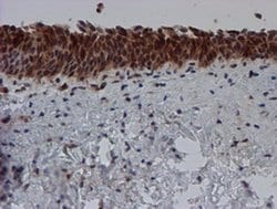 SAT2 Monoclonal Antibody (OTI1C9), TrueMAB , OriGene 100 &mu;L; Unconjugated:Antibodies,
