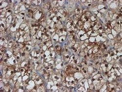 SAT2 Monoclonal Antibody (OTI1C9), TrueMAB , OriGene 100 &mu;L; Unconjugated:Antibodies,