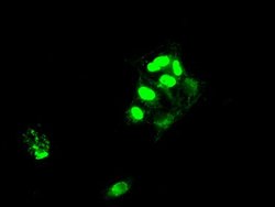 SATB1 Mouse anti-Human, Clone: OTI11H4, lyophilized, TrueMAB 100 &mu;g;
