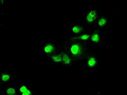 SATB1 Mouse anti-Human, Clone: OTI6C6, lyophilized, TrueMAB 100 &mu;g;